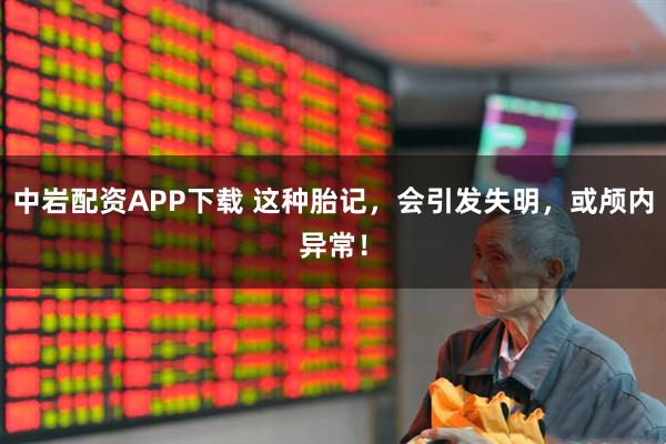 中岩配资APP下载 这种胎记，会引发失明，或颅内异常！